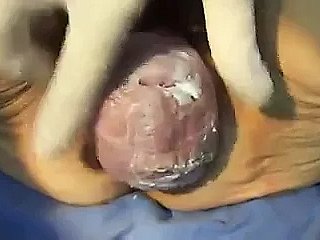 Vagina Nenek