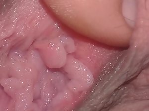 Numbing Conchita abierta arg.
