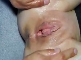 Greedy teen old bag huge fisting penetrations