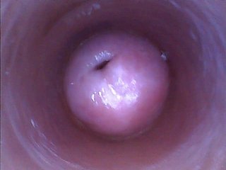 基拉 - 淫自拍照（内窥镜猫凸轮视频）